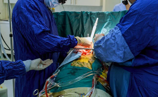 Los cirujanos realizan la operación. Primer plano de la mano del médico en guantes durante la operación . — Foto de Stock