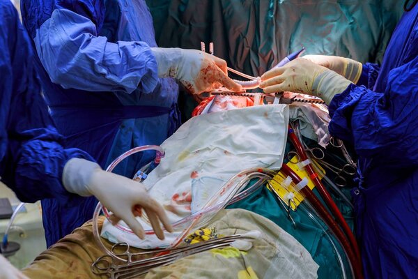 Closeup of doctor's hand in gloves in the blood holds the forceps during the operation.