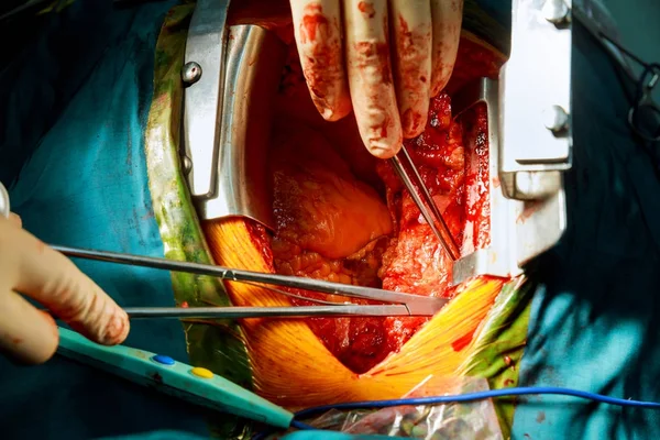 Utilizando diferentes herramientas quirúrgicas durante la operación — Foto de Stock