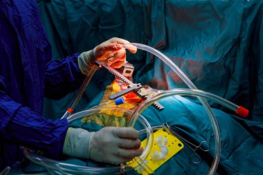 Cerrahlar işlemi gerçekleştirmek. Doktorun elinde eldiven işlemi sırasında closeup.