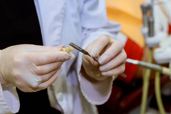 Közelről fotó a fogorvos kezei fogászati eszközök. — Stock Fotó