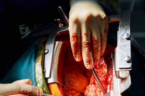 Gyermek szívsebészet, közeli orvos ezzel a szív működése — Stock Fotó
