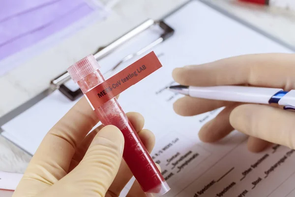 Blood sample with Middle East respiratory syndrome coronavirus MERS-CoV — 스톡 사진