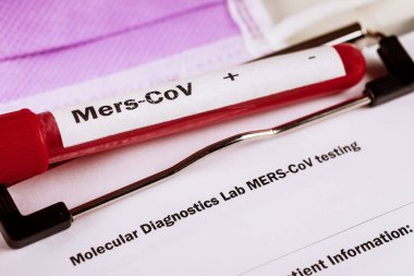 Mers-Cov Ortadoğu solunum sendromu Corona virüsü ile kan testi tüpleri
