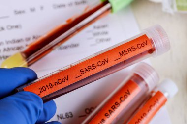 2019-ncov, Sars-Cov, Mers-Cov, 229 e, Nl63, Oc43, Hku1, atipik zatürree, virüs tanımı Orta Doğu Solunum Sendromu Kan Testi
