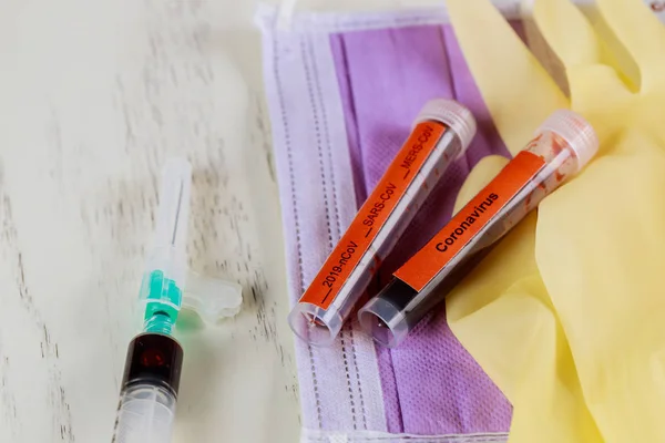 Εργαστηριακό πραγματικό δείγμα αίματος ιατρική σύριγγα άτυπη πνευμονία ιού — Φωτογραφία Αρχείου
