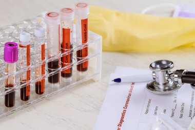 2019-ncov, Sars-Cov, Mers-Cov, 229 e, Nl63, Oc43, Hku1, atipik zatürree, virüs tanımı Orta Doğu Solunum Sendromu Kan Testi
