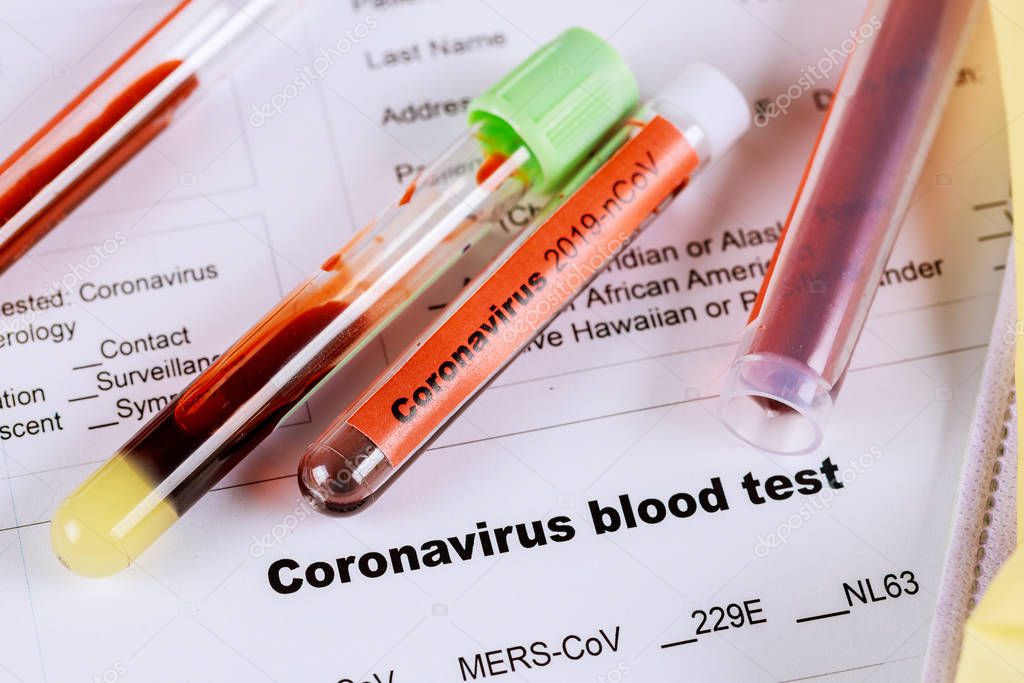 MERS CoV Middle East respiratory syndrome coronavirus with blood sample