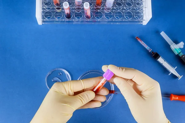 Vial de muestra de sangre de mano en laboratorio — Foto de Stock