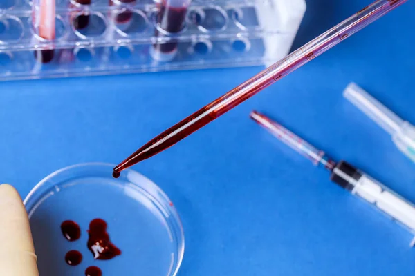 Blood test tube in a medical analysis hospital laboratory — 图库照片