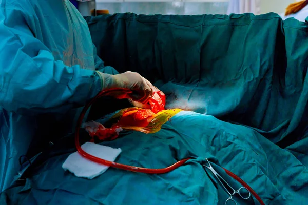 Cirujanos de trabajo en equipo durante cirugía a corazón abierto médico sosteniendo instrumentos quirúrgicos — Foto de Stock