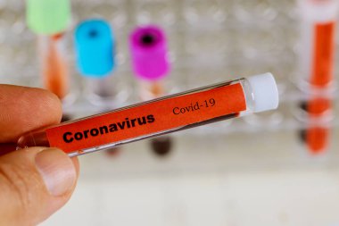 Coronavirus blood test Covid-19, 2019-nCoV,SARS-CoV, MERS-CoV blood test in Laboratory