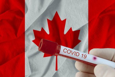 COVID-19 Coronavirus Çin enfeksiyonu olan kan örneği tıbbi muayene laboratuvarında test edildi.