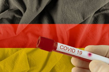 COVID-19 Coronavirus Çin enfeksiyonu olan kan örneği tıbbi muayene laboratuvarında test edildi.