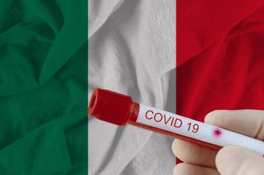 KOVID-19 Coronavirus Çin enfeksiyonu olan kan örneği tıbbi muayene laboratuvarında test edildi.