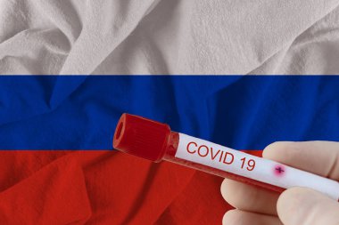 COVID-19 Coronavirus Çin enfeksiyonu olan kan örneği tıbbi muayene laboratuvarında test edildi.