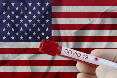 ABD 'de COVID-19 Coronavirus Çin enfeksiyonu olan kan örneği tıbbi muayene laboratuvarında test edildi.