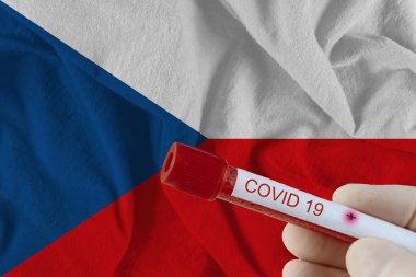 Çek Cumhuriyeti 'nde COVID-19 Coronavirus Çin enfeksiyonu olan kan örneği tıbbi muayene laboratuvarında test edildi