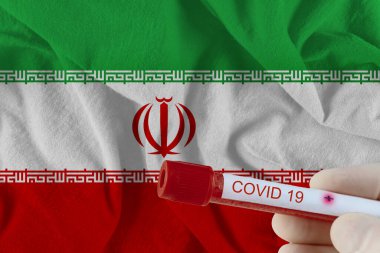COVID-19 Coronavirus Çin enfeksiyonu olan kan örneği tıbbi muayene laboratuvarında test edildi.