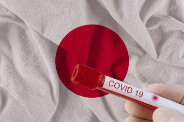COVID-19 Coronavirus Çin enfeksiyonu olan kan örneği tıbbi muayene laboratuvarında test edildi.