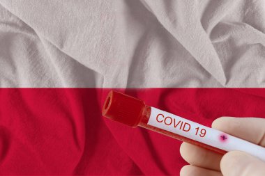 COVID-19 Coronavirus Çin enfeksiyonu olan kan örneği tıbbi muayene laboratuvarında test edildi.
