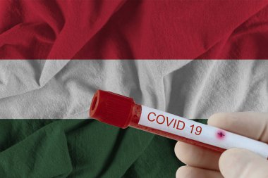 Çin enfeksiyonunda COVID-19 enfeksiyon testi. Macaristan 'ın Corona virüsü.