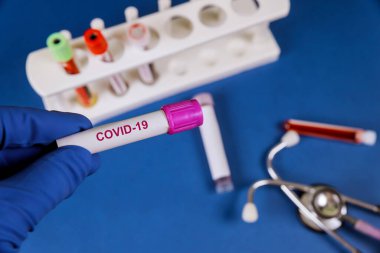 Coronavirus test tüpü, covid-19 için kan testi talep formu.