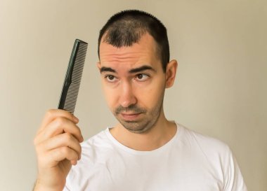 Erkek model siyah saç. Yakın çekim saç kaybı. Saç fırçası.