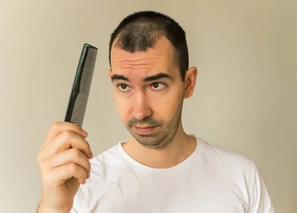 Erkek model siyah saç. Yakın çekim saç kaybı. Saç fırçası.