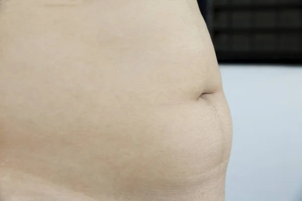 fat female body part - she will have to loose some weight