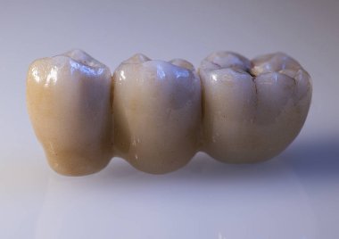 makro diş implantı renginin fotoğrafı