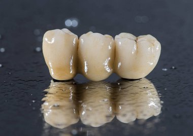 makro diş implantı renginin fotoğrafı
