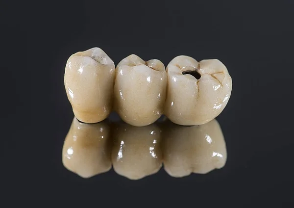 makro diş implantı renginin fotoğrafı