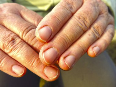 Yaşlı bir köylü kadının kaba ve yıpranmış elleri