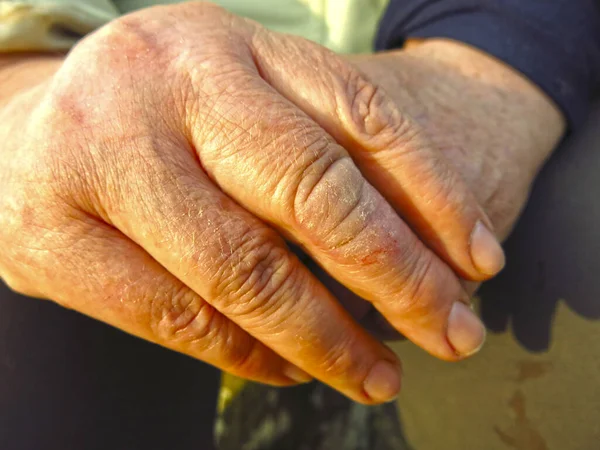 Rough Weathered Hands Elderly Peasant Woman Close — Stock Photo, Image