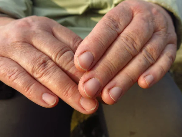 rough and weathered hands of an elderly peasant woman close up