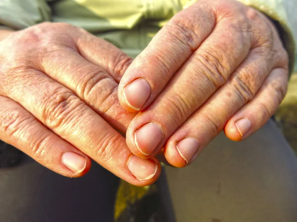 Mãos Ásperas Resistidas Uma Mulher Camponesa Idosa Fecham — Fotografia de Stock