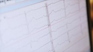 Seit zwei tagen starkes herzklopfen und nachtschweiß Herzschlag linie Stockvideos, lizenzfreies Herzschlag linie