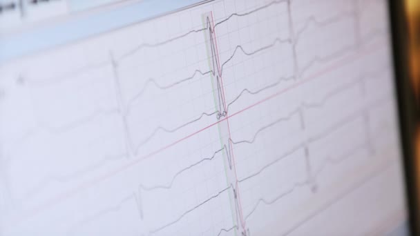 Fale EKG na monitorze Szpital — Wideo stockowe