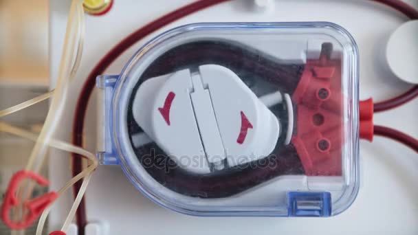 Hemodialys maskiner med slangar och installationer. Hälso-och sjukvård, blod rening, njursvikt, transplantation, medicinsk utrustning koncept. Närbild — Stockvideo