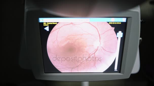 Oko test komputera obraz siatkówki, Wyświetlono wzrokowego bańki — Wideo stockowe