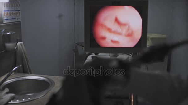 Médico gastroenterologista com sonda para realizar gastroscopia e colonoscopia realiza o procedimento — Vídeo de Stock