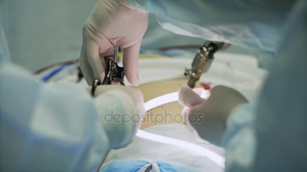 Команда хирургов перед операцией в стационаре, хирург оперирует пациента, носит хирургическое платье, операционную, держится за руки, работает с хирургическими инструментами. Лапароскопия, крупный план — стоковое видео