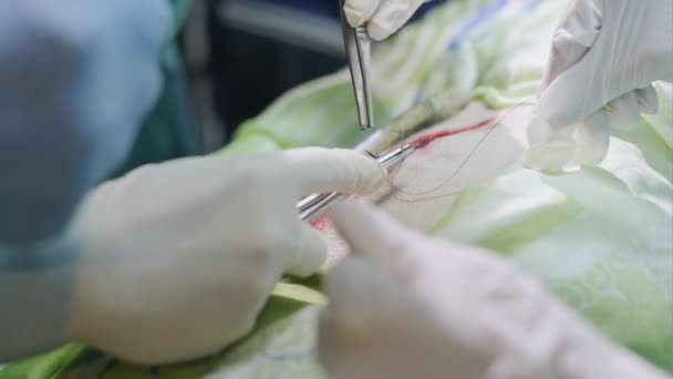 Kesik dikiş cerrahlar — Stok video