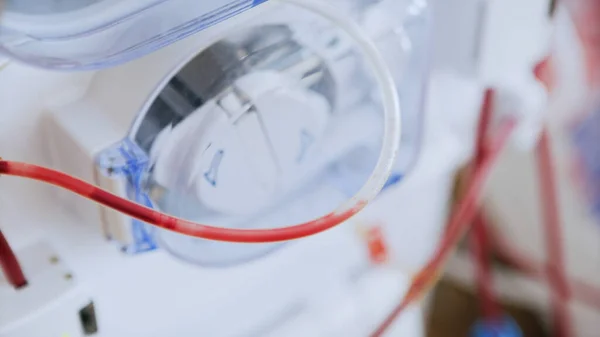 Bloddialys rening medicinsk procedur - plasmaferes, med medicinska enheten på sjukhus — Stockfoto