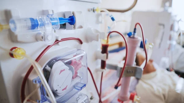 Bloedlijn buizen met hemodialyse machine op de achtergrond. Gezondheidszorg, zuivering van het bloed, nierfalen, transplantatie. — Stockfoto