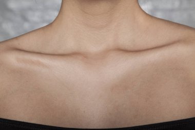 bir kadın, kötü beslenme ya da hastalık sıska kemik