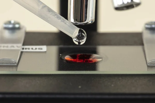 Δείγμα Αίματος Τοποθετημένο Αντικειμενοφόρο Μικροσκόπιο — Φωτογραφία Αρχείου