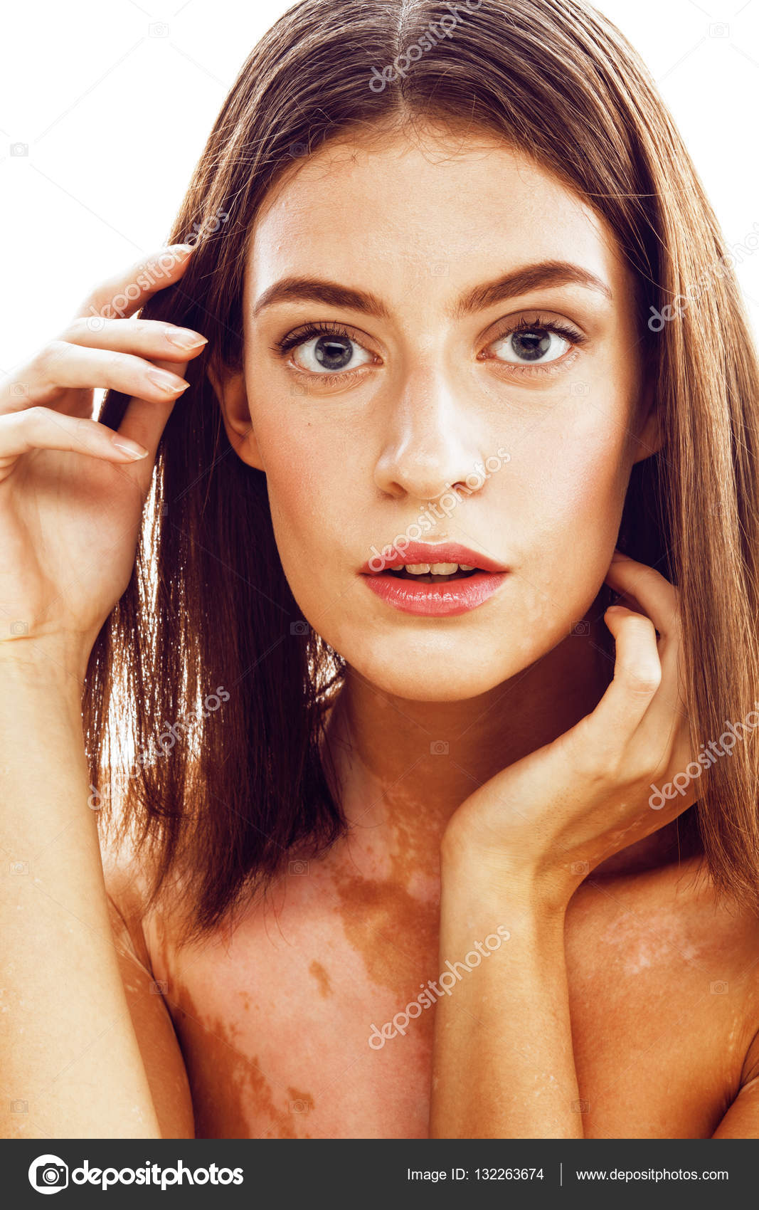 jonge brunette vrouw met vitiligo Stockfoto iordani jonge brunette vrouw met vitiligo Stockfoto iordani