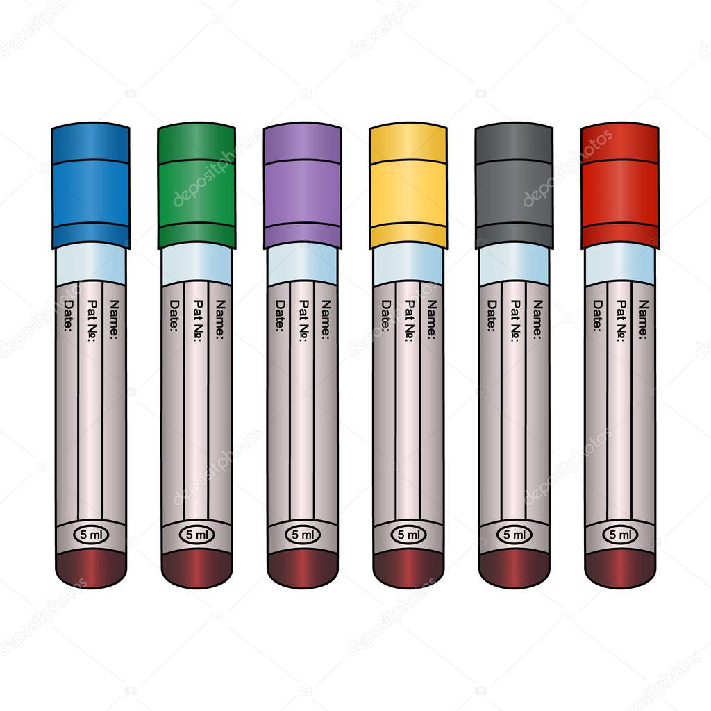 Tubes with blood tests of patients. Set of vector illustrations. Isolated background. Place for your text. Various types of research. Plasma diagnostics. Collection with colored caps. Collection of clinical samples. Medical topics.
